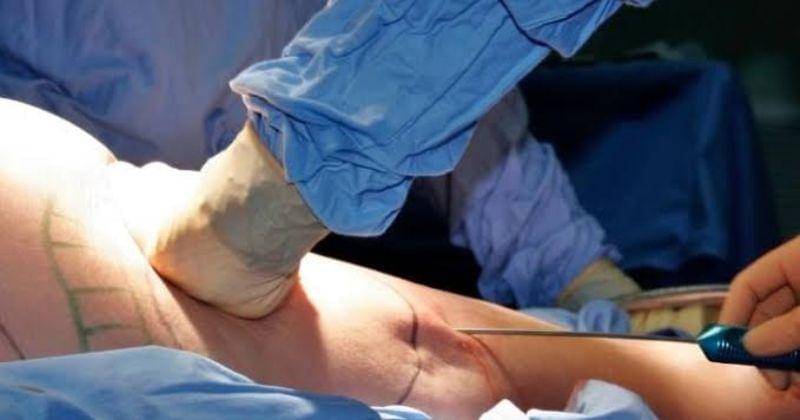 Dok. MedicalNewsToday